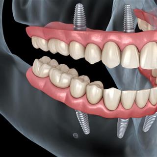 دندانپزشکی