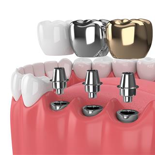 دندانپزشکی