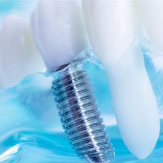 دندانپزشکی