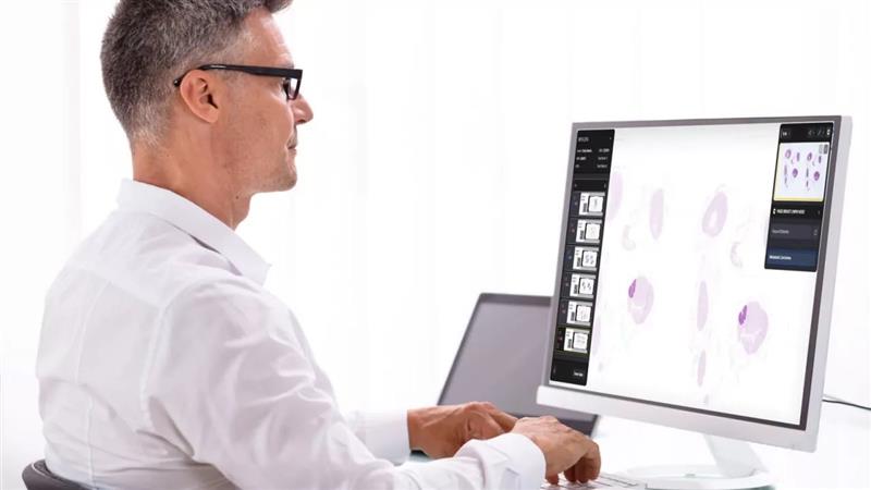 بزرگ‌ترین مدل هوش مصنوعی مایکروسافت برای تشخیص سرطان